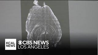 UCLA Brain Mapping in Westwood | KCAL Cares