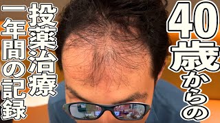 40歳から1年間AGA（投薬治療）の経過観察をした結果