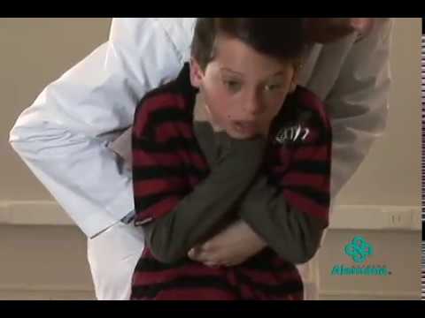 Maniobra de heimlich en adultos y niños