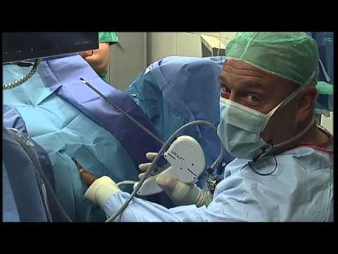 Video tun Prostatamassage Ehemann Die Behandlung von Wermuth Prostatakrebs