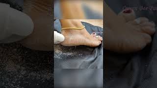 Fix Dry Cracked Feet / heels instantly - பாத வெடிப்பு சரி செய்ய Tips & Tricks - Foot crack
