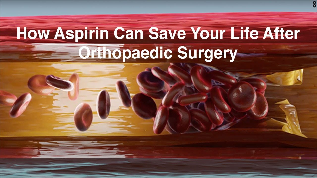 Aspirin Can Prevent Life-Threatening Blood Clots After Orthopedic Surgery For A Lot Less Money