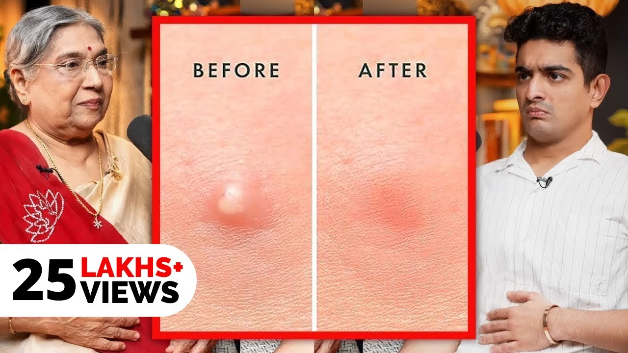 Fastest Pimple Healing Exercise & Hacks Explained - Yoga For Clear Skin