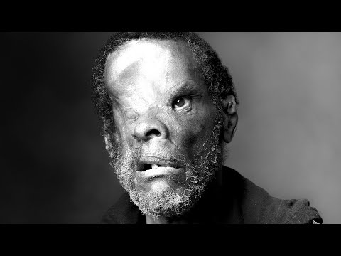 Shooting Victim-Jerry 2020 (Part 1)