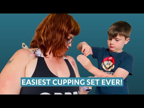 This is so easy even my KIDS can do it! Dr Kez Chirolab Vacuum Cupping at home for faster recovery.