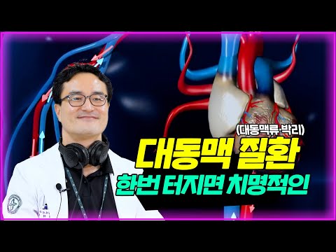 한번 터지면 치명적인 대동맥 질환ㅣ대동맥류·대동맥박리ㅣ닥터DJ