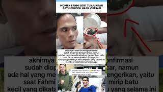 Download lagu Momen Fahmi menunjukkan batu emp3du setelah di oper4si #beritaartis #fahmibo #raffiahmad #trending mp3 Download lagu Momen Fahmi menunjukkan batu emp3du setelah di oper4si #beritaartis #fahmibo #raffiahmad #trending mp3