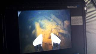 preview picture of video 'MSD Dive Cuyuna - 65 ft. shaft in Hopkins Mine'