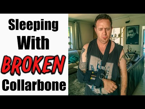 Best Sleep Position for a BROKEN Collarbone | Clavicle Healing