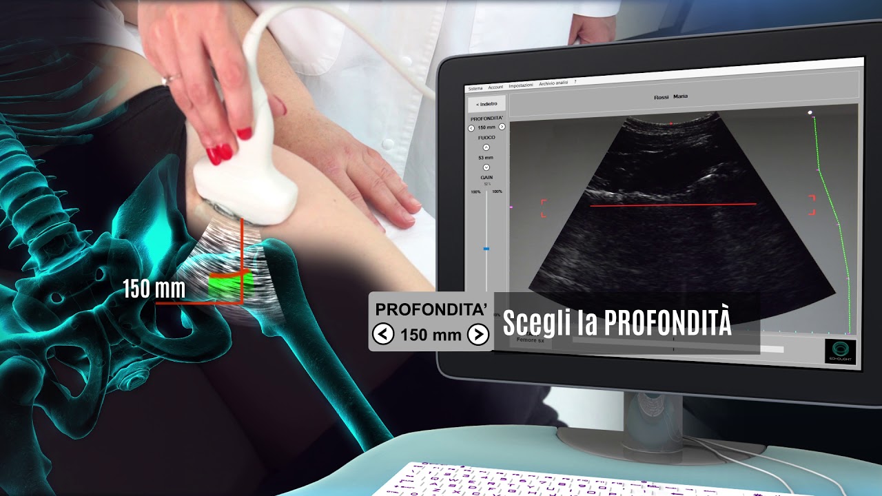 Echolight Demo Scansione Femore