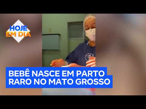 Bebê nasce ainda dentro da bolsa amniótica em parto raro em Mato Grosso