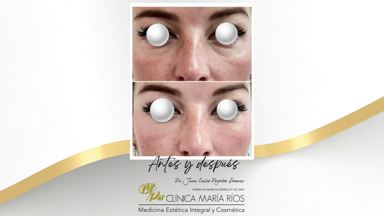 Juan Carlos Poyatos Serrano-3