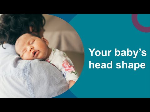 Your baby's head shape