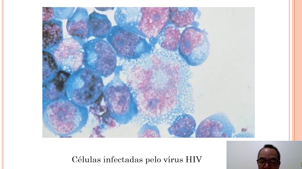 HIV - Imunologia