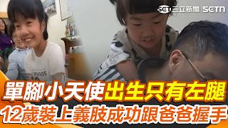 單腳小天使徐又立「出生只有左腿」從小立志當醫生！ 12歲裝上義肢「成功跟爸爸握手」感動無數人【人生驚嘆號】｜三立新聞網 SETN.com