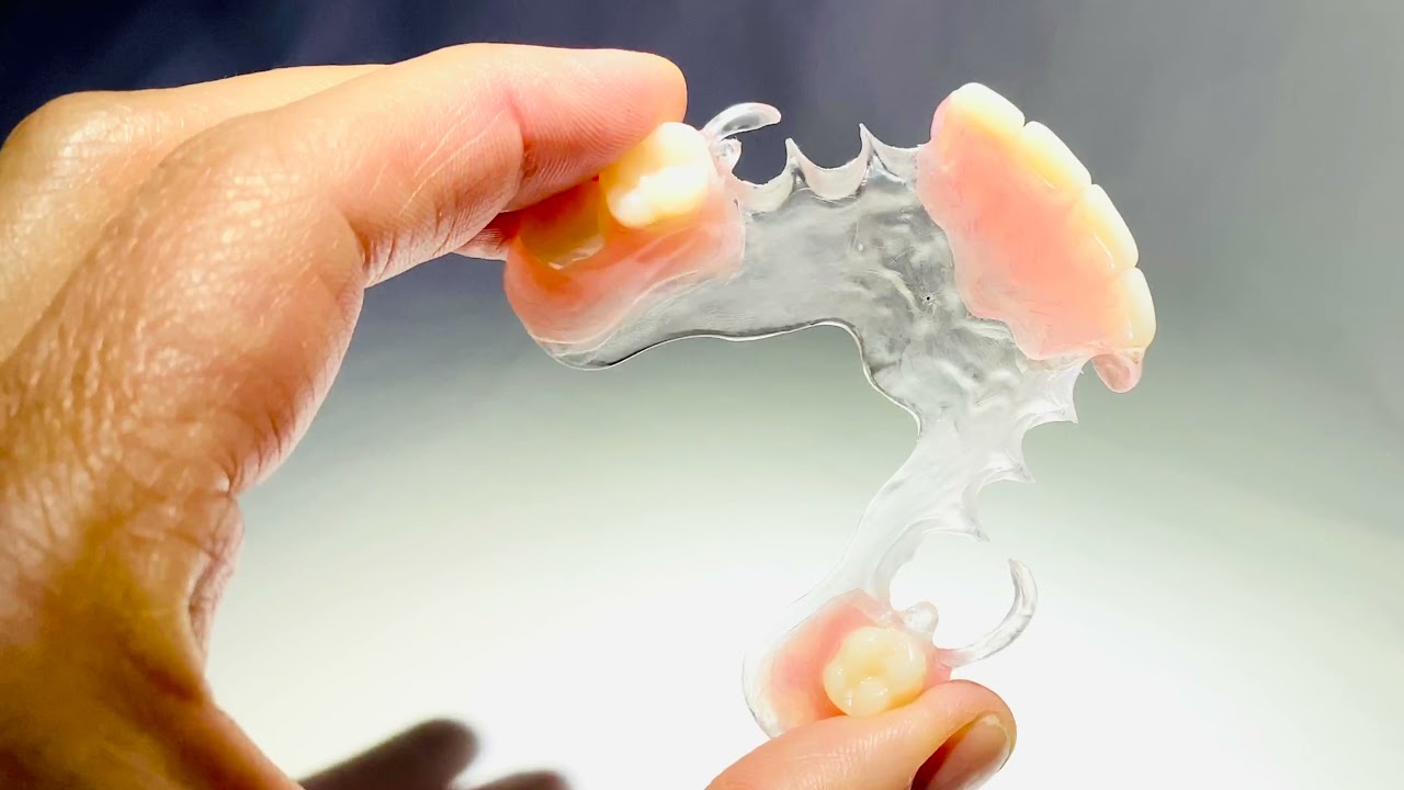 Kameleon from Knight Dental Lab