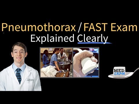 Pneumothorax on Ultrasound - FAST Exam Explained Clearly