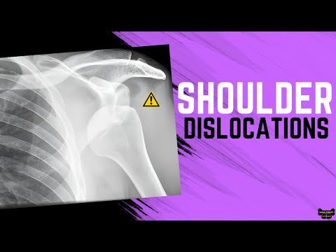 Anterior Shoulder Dislocation vs Posterior Shoulder Dislocation (Radiographic Differences)