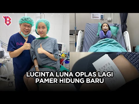 Lucinta Luna pamer hidung baru usai oplas lagi, netizen auto ngilu & sebut makin aneh | NEWSFLASH