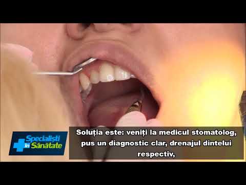 Abcesul dentar este o urgenta stomatologica. Simptomele - Clinicile Dentare Dr. Leahu