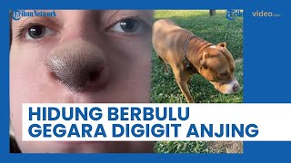 Hidung Gadis Asal Pennsylvania Ini Ditumbuhi Rambut seusai Digigit Seekor Anjing