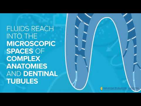 The GentleWave Procedure At Advanced Endodontics