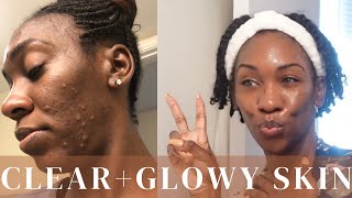 How I Keep My Skin Super CLEAR & GLOWY! | Nicolee Sutton