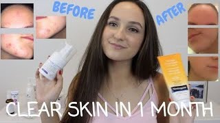 CLEAR SKIN IN 1 MONTH: How To Get Rid of Acne & Scarring FAST