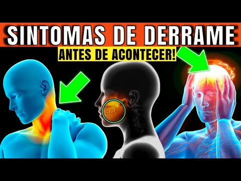 7 SINTOMAS DE UM AVC IMINENTE QUE VOCÊ NÃO DEVE IGNORAR | PREVENÇÃO DO DERRAME e da DOENÇA VASCULAR