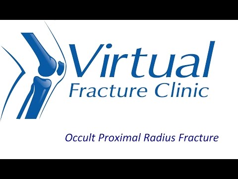 Occult Proximal Radius Fracture