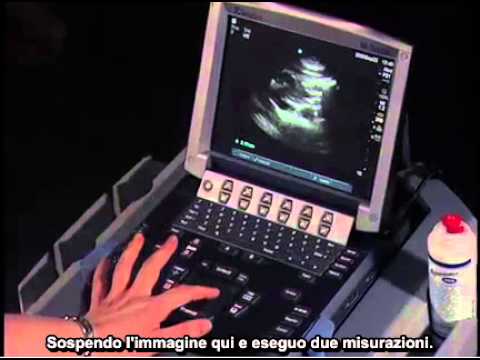 Sanatorio a Odessa trattamento articolazioni Osgood-Schlatter con la funzione alterata della malattia articolare