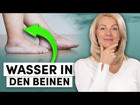 Water retention in your legs? Here's how to get rid of the swelling quickly (without surgery)