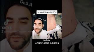 Eingewachsenes Haar und beginnende Infektion #shorts - Dr. Alawi