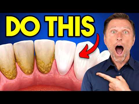 The #1 BEST Remedy for Dental Plaque (TARTAR)