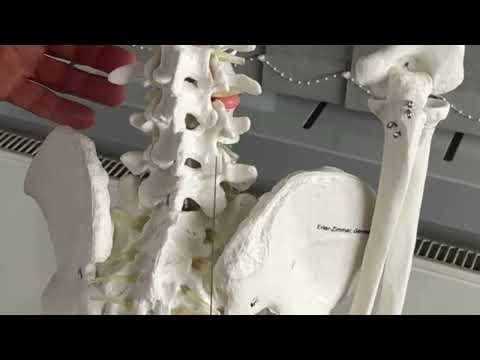 Die Facettendenervation und Eigenbluttherapie bei Rückenschmerzen