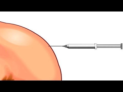 How Vaccines Work in the Human Body Animation - YouTube