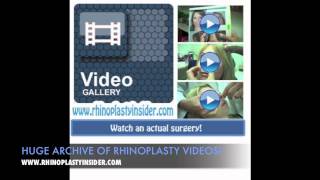 preview picture of video 'Best Rhinoplasty Surgeon Ratings in USA and Canada'