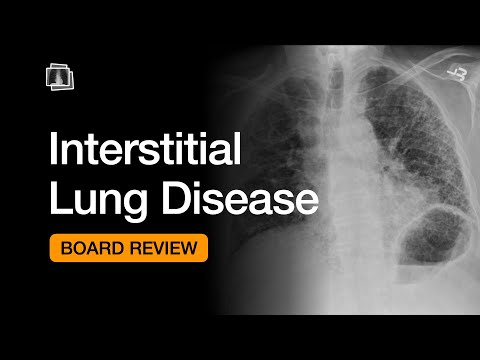 Interstitial Lung Disease | Chest Radiology Board Review