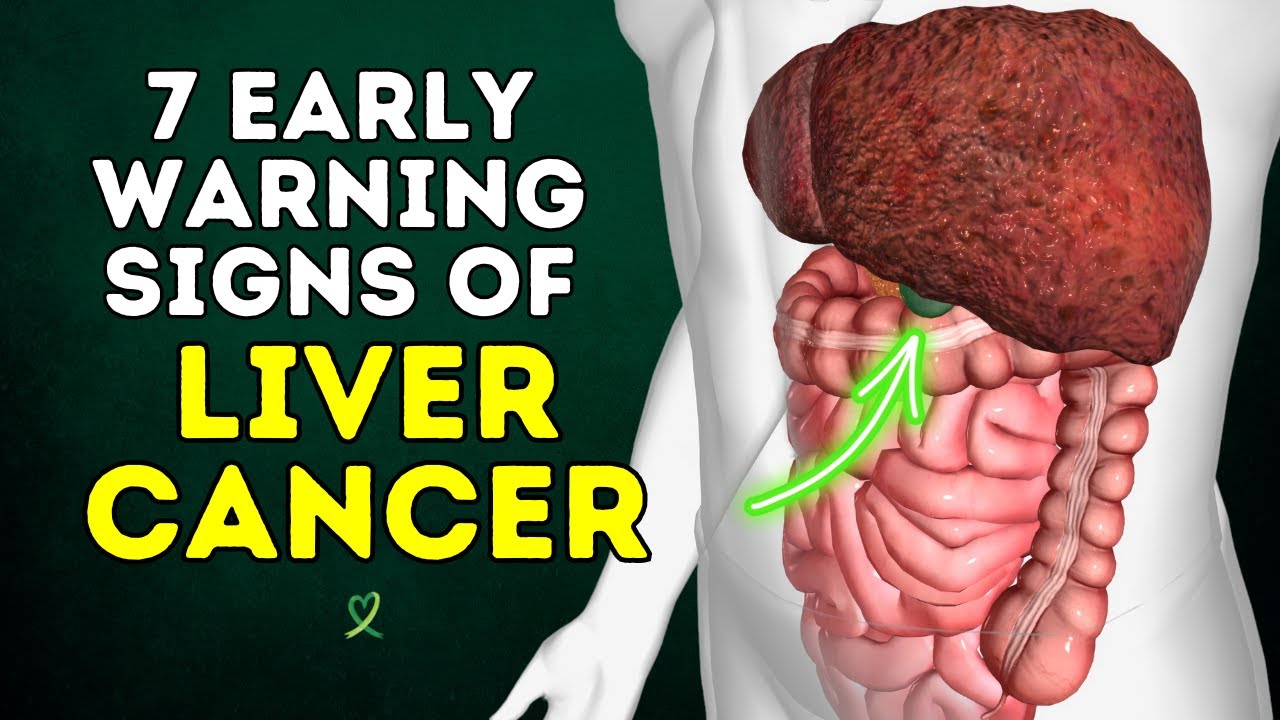 7 Early Warning Signs of Liver Cancer