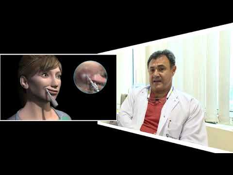 Spitali Amerikan – Dr. Andrea Palmieri - FESS