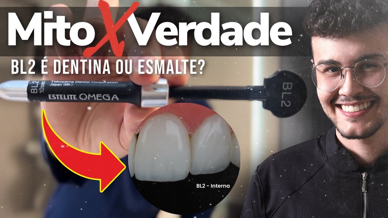 BL2 é Esmalte ou Dentina? Onde, como e quando usar esta resina nas suas Facetas?