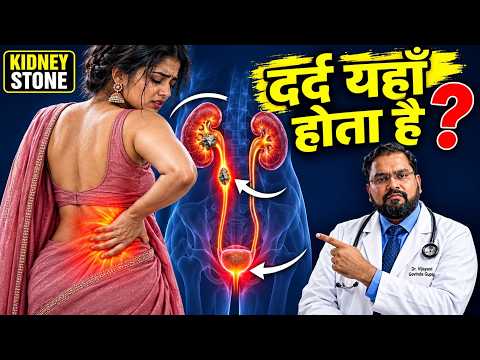 Kidney Stone Pain | Symptoms in Hindi | पथरी का दर्द कहाँ होता है?