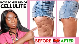 How to get rid of CELLULITE on your THIGHS, LEGS & BUTT ?Home Remedies?| Workout | Creams & more