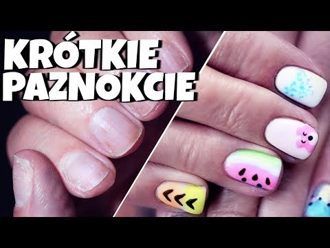 Buty ortopedyczne dla dzieci koślawego Stan zapalny kości ale przystanek