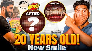 This Smile Makeover Will SHOCK You (He Cried in My Chair)