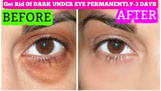 How To Get Rid Of Dark Circles In 3 Days Permanently | SuperPrincessjo