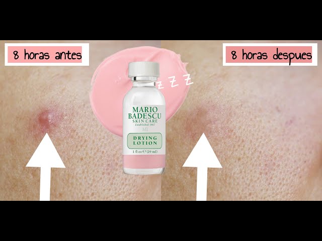 Vídeo relacionado con Botella de loción de secado, de Mario Badescu, de 29 ml