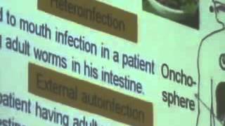 Dr Azza 6 9 11 2014   YouTube