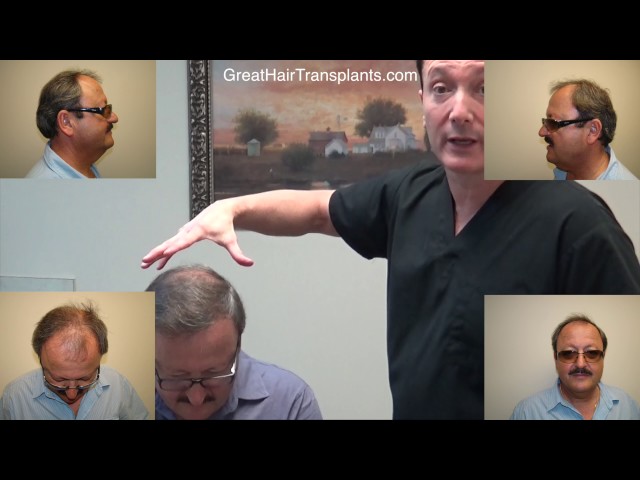 

Dr. Brett Bolton Patient Peter MaxHarvest&trade;


