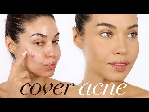 HOW TO COVER ACNE with MAKEUP | Eman